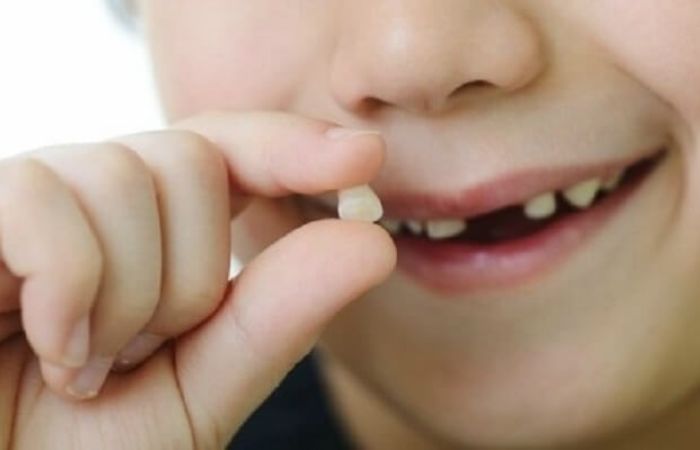 Mơ thấy người thân bị gãy răng có ý nghĩa gì?