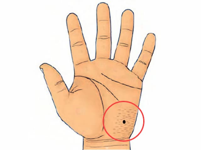 Ý nghĩa chung của nốt ruồi trong lòng bàn tay cần biết